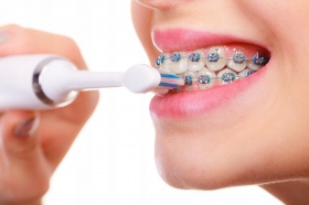 Можно ли использовать электрическую зубную щетку с брекетами?